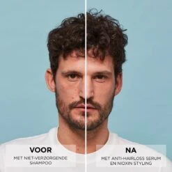 Nioxin Anti-Hairloss Serum 70ml -L'Oreal Verkoop 361 03