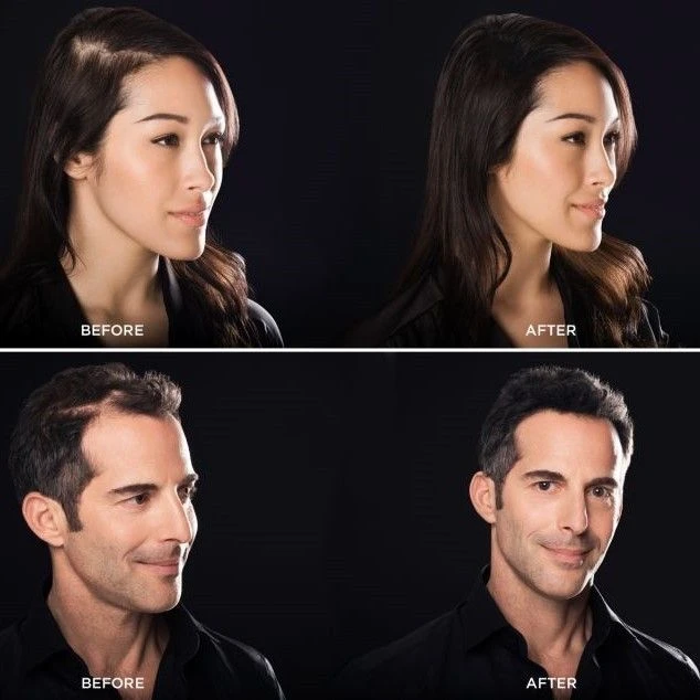 Toppik Hair Building Fibers Medium Blonde 12gr Toppik Hair Building Fibers Medium Blonde 12gr -L'Oreal Verkoop melina and jonathan bacr 2 2 24