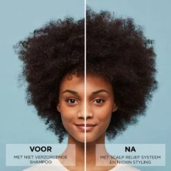 Nioxin Scalp Relief Conditioner 200ml -L'Oreal Verkoop nioxin scalp relief conditioner before and after 6