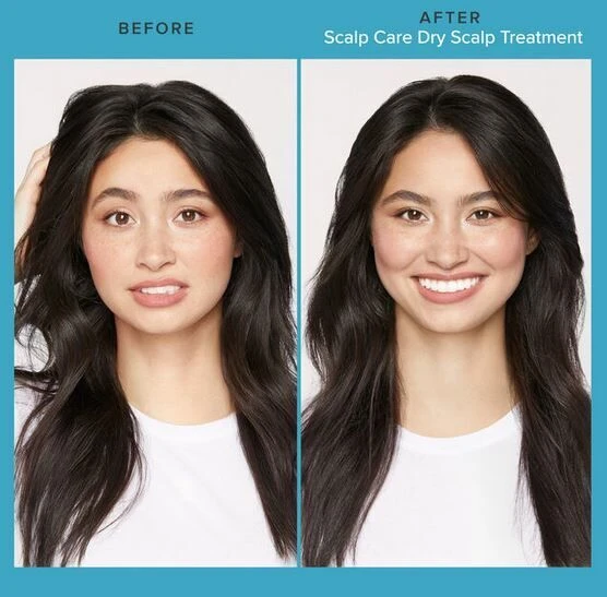 Living Proof Scalp Care Dry Scalp Treatment 100ml Living Proof Scalp Care Dry Scalp Treatment 100ml -L'Oreal Verkoop scalp care dry scalp sfeerfoto 2