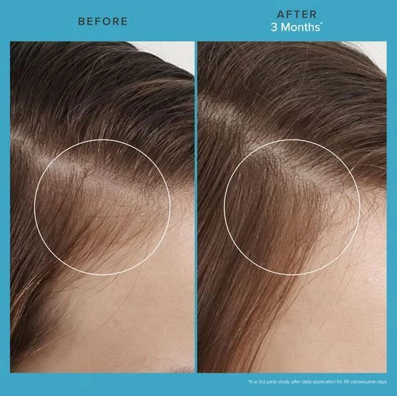 Living Proof Scalp Care Revitalizing Treatment 73ml Living Proof Scalp Care Revitalizing Treatment 73ml -L'Oreal Verkoop scalp care revitalizing treatment 5